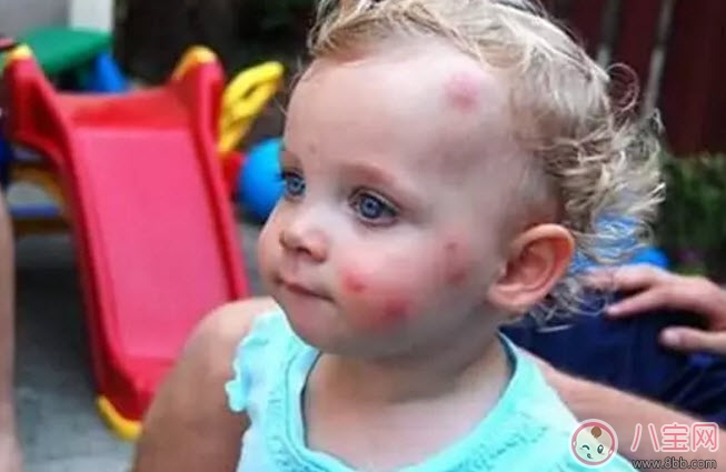 夏天寶寶驅(qū)蚊方法大全 寶寶驅(qū)蚊成分哪種安全有效