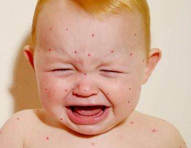 風油精寶寶能用嗎    寶寶使用風油精的危害