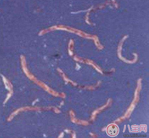 喝生水長(zhǎng)寄生蟲是真的嗎 喝生水會(huì)有寄生蟲嗎