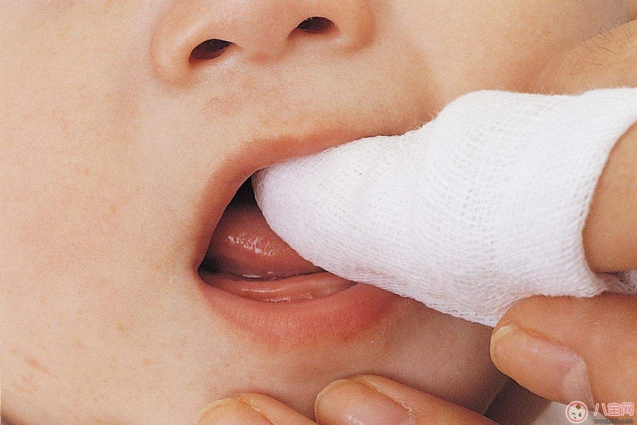 母乳寶寶的牙齒保健 如何護(hù)理寶寶牙齒