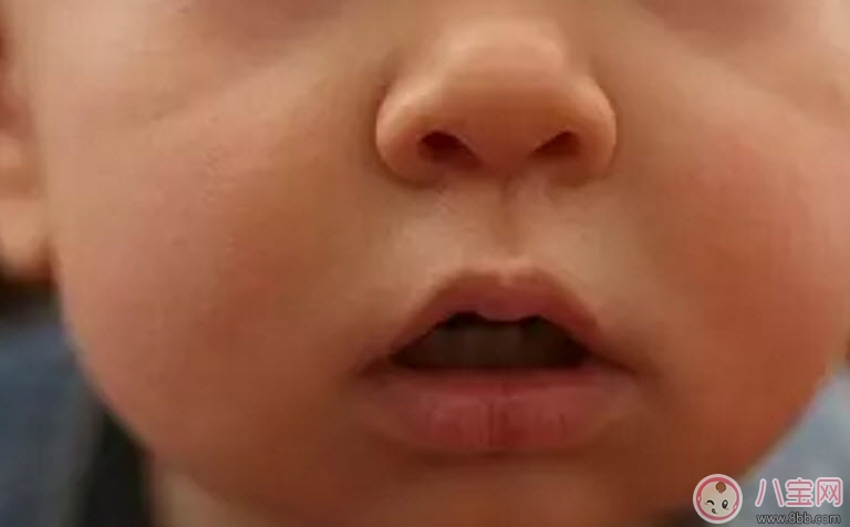 秋天怎么預(yù)防寶寶口角炎 寶寶口角炎的食療方法 秋天怎么預(yù)防寶寶口角炎 寶寶口角炎的食療方法