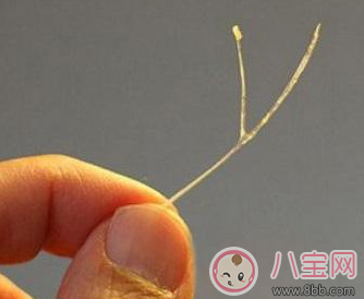 寶寶吃魚卡魚刺 急著自己去夾刺就大錯特錯了