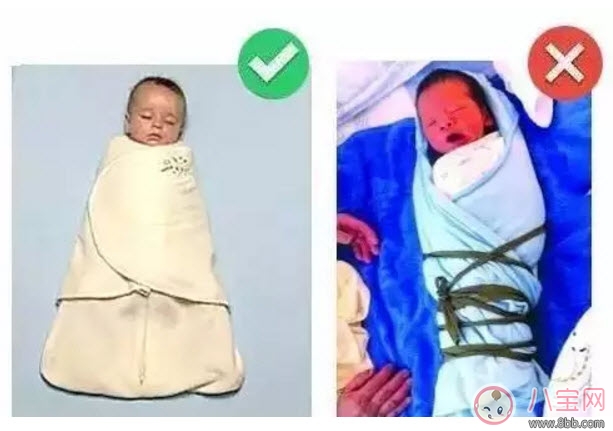 嬰兒為什么是青蛙腿 寶寶青蛙腿用不用綁腿