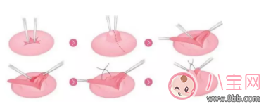 母乳喂養(yǎng)很艱難 別不小心走到坑里面去了