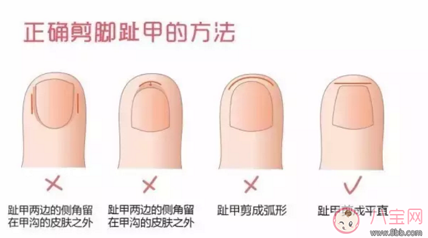 錯(cuò)誤的方法剪指甲會(huì)剪到肉 怎么給孩子剪指甲