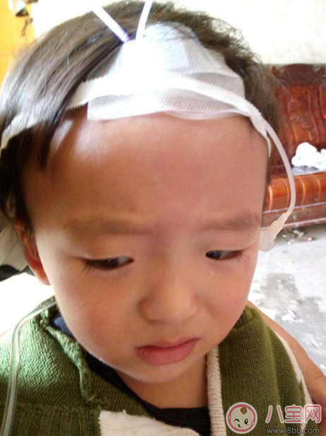 秋季腹瀉孩子狀態(tài)差 及時預防遠離它