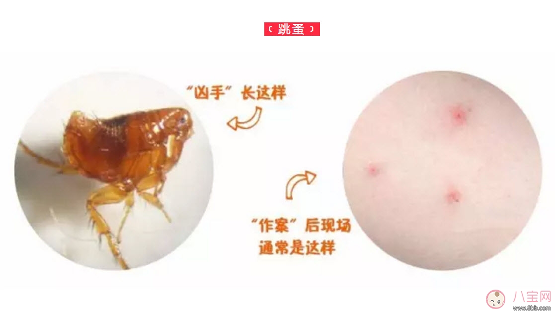 寶寶被跳蚤咬了癥狀圖片 寶寶被跳蚤咬和蚊子咬癥狀對(duì)比圖片區(qū)別 寶寶被跳蚤咬了癥狀圖片 寶寶被跳蚤咬和蚊子咬癥狀對(duì)比圖片區(qū)別