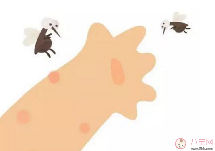 寶寶被臭蟲咬了癥狀圖片 寶寶被臭蟲咬和蚊子咬癥狀對比圖片區(qū)別 寶寶被臭蟲咬了癥狀圖片 寶寶被臭蟲咬和蚊子咬癥狀對比圖片區(qū)別