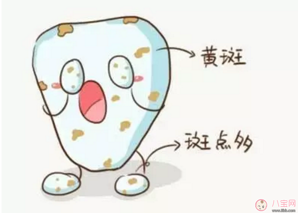 寶寶沒有齲齒 卻有黑牙是怎么回事？