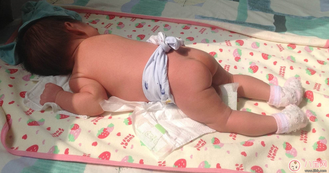 覺得孩子越曬越健康 不要把孩子曬傷了再去后悔