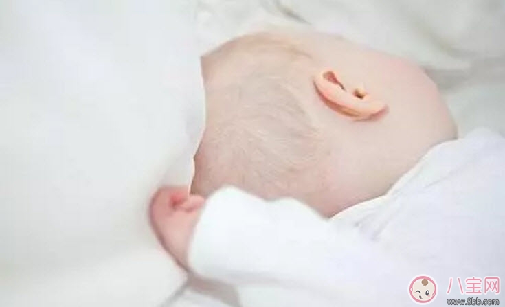 新生兒頭上的乳痂一般什么時候消失 為什么有的寶寶長乳痂有的不長