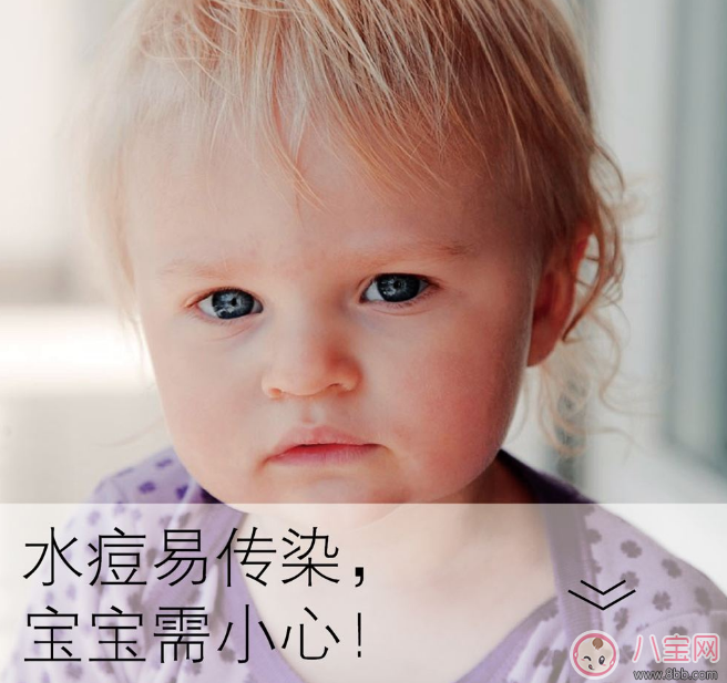 孩子長(zhǎng)水痘這些東西千萬(wàn)遠(yuǎn)離 孩子水痘好得快方法 孩子長(zhǎng)水痘這些東西千萬(wàn)遠(yuǎn)離 孩子水痘好得快方法