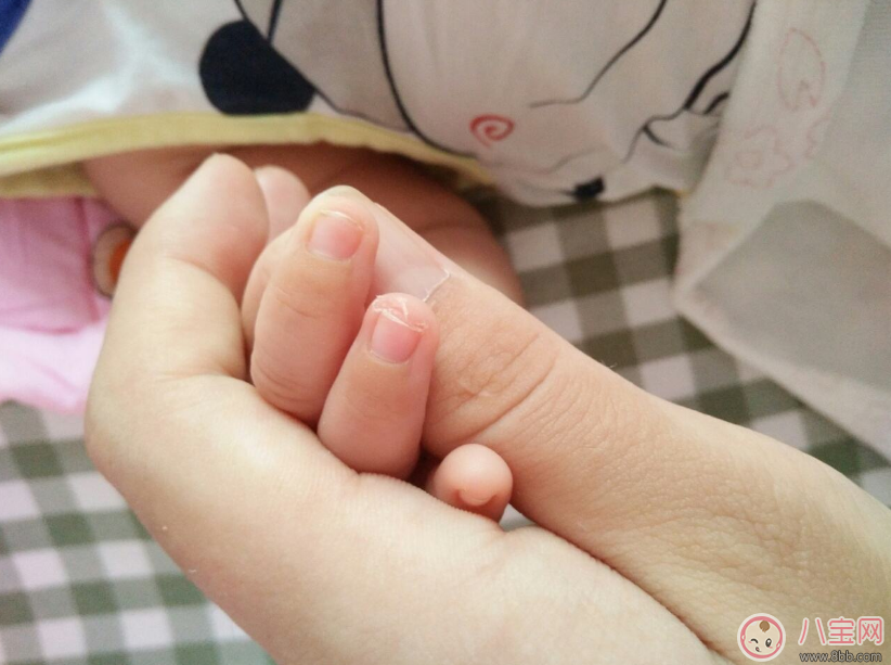 寶寶指甲暗藏大奧秘 從指甲也能看出寶寶的健康狀況 