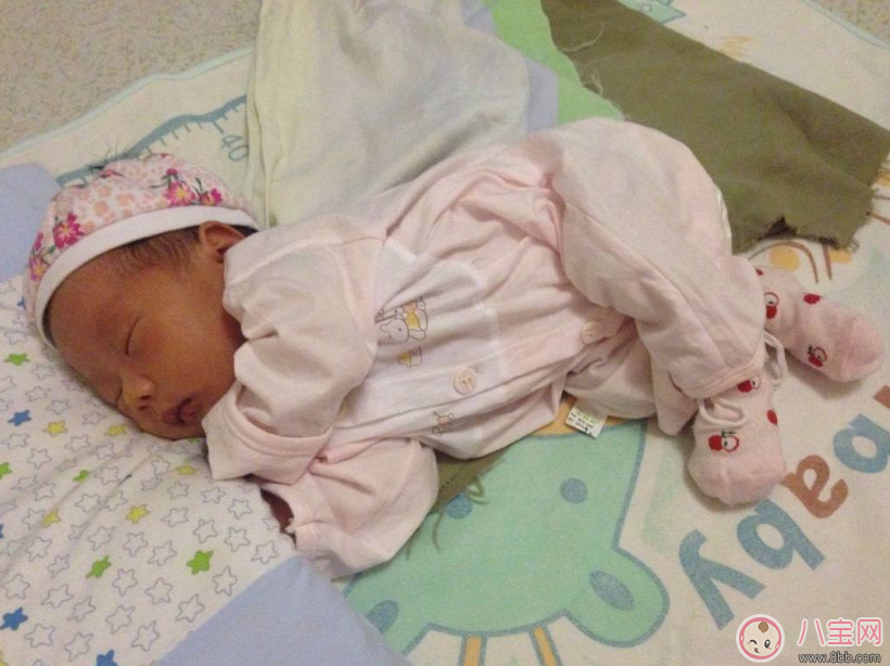 寶貝頭型太扁了可以矯正嗎 寶寶頭型睡回來方法 寶貝頭型太扁了可以矯正嗎 寶寶頭型睡回來方法