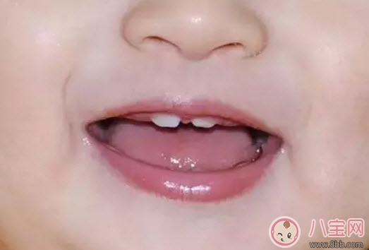 寶寶牙縫寬是什么原因 寶寶牙縫寬會(huì)自己閉攏嗎