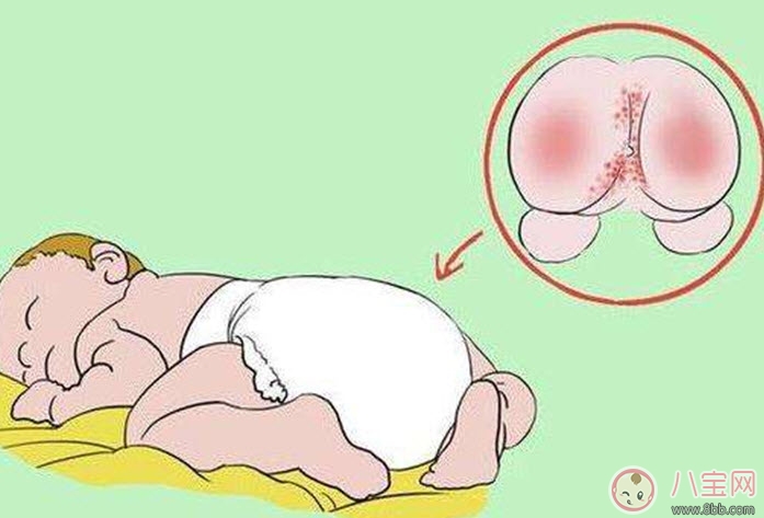 寶寶紅屁股哭鬧怎么辦 寶寶紅屁股安撫物品