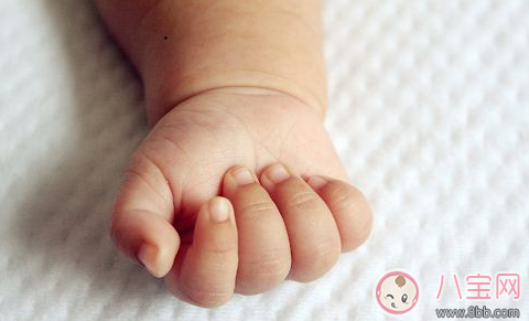 孩子手上長(zhǎng)倒刺 寶媽應(yīng)該這么做 孩子手上長(zhǎng)倒刺 寶媽應(yīng)該這么做