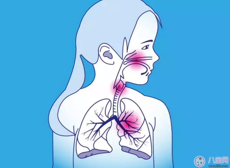 寶寶肺炎反反復復怎么辦 寶寶得了肺炎怎么治療