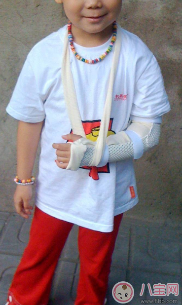 孩子總是容易骨折 孩子骨折后怎么處理