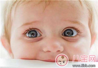 嬰幼兒眼睫毛如何修剪及矯正 嬰幼兒眼睫毛如何修剪及矯正