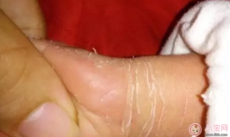 新生兒手腳脫皮要多久 新生兒脫皮怎么護理(能搽點什么)