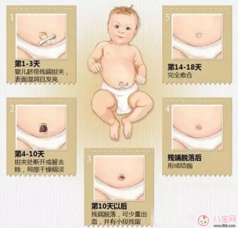 新生兒臍帶脫落的時(shí)間是幾天 新生兒臍帶脫落的過程圖解