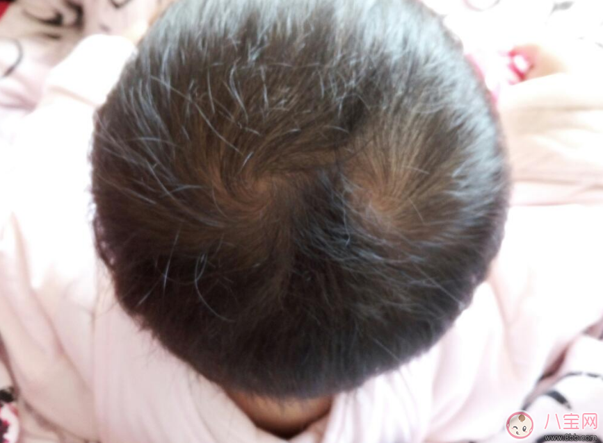 孩子頭上的旋有什么含義 幾個(gè)旋比較聰明 孩子頭上的旋有什么含義 幾個(gè)旋比較聰明