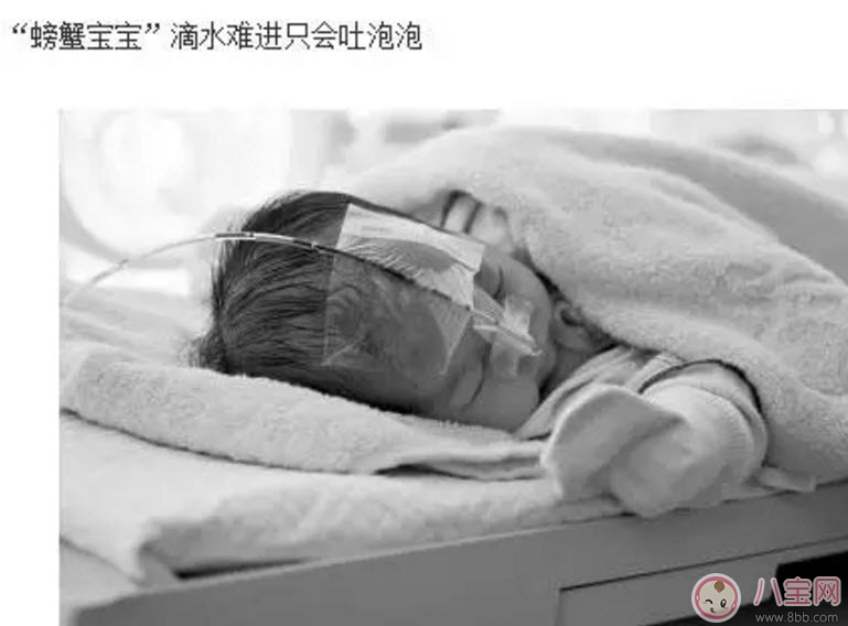 寶寶吐泡泡就是肺炎嗎 寶寶吐泡泡是怎么回事