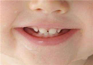 寶寶長牙順序 寶寶長牙特征(寶寶長牙癥狀)
