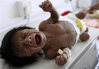 孩子這種情況居然是營養(yǎng)不良的暗示 快給孩子調(diào)整過來