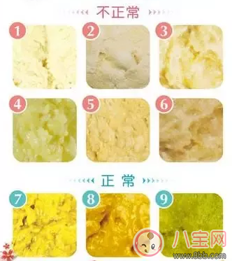 寶寶大便顯示了寶寶的狀況 注意寶寶排便頻率