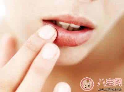 夏季孕婦上火嘴唇起泡的原因 如何治療 夏季孕婦上火嘴唇起泡的原因 如何治療