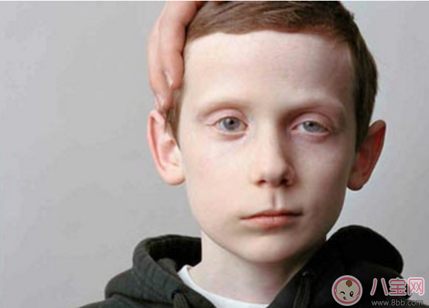 兒童吹空調(diào)竟然導致面癱 如何正確吹空調(diào)