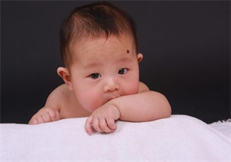 寶寶胎記會自己掉嗎 寶寶胎記去除方法