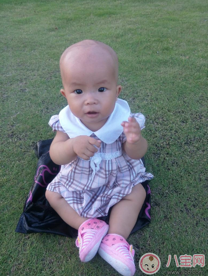 孩子夏天剃光頭 小心一不小心變禿頭