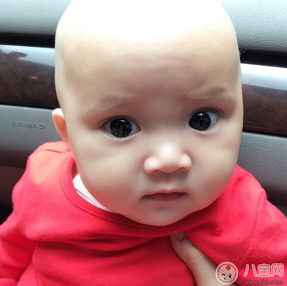 孩子夏天剃光頭 小心一不小心變禿頭