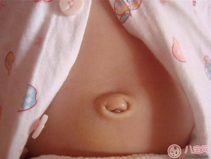 寶寶肚臍護(hù)理有方法 三不要方法要記牢