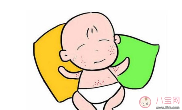 2017夏天孩子長(zhǎng)痱子有什么偏方 去治痱子偏方有哪些