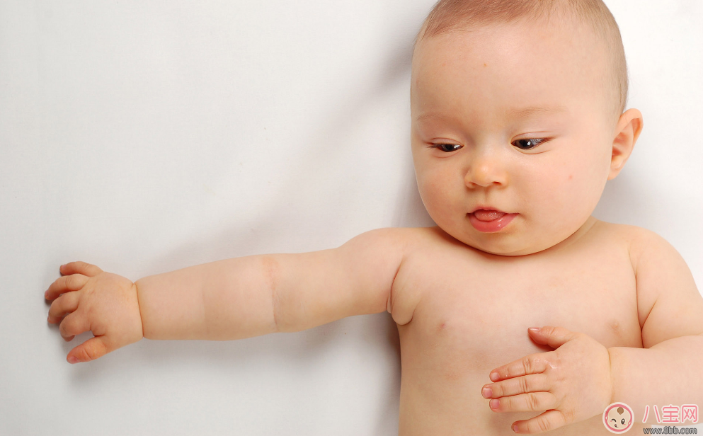 糖寶寶在嬰兒時(shí)期有哪些癥狀 怎么預(yù)防唐氏綜合癥