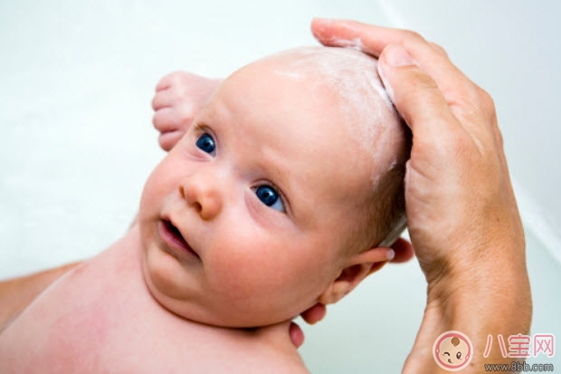 頭垢對寶寶的影響 頭垢怎么去除有哪些注意事項
