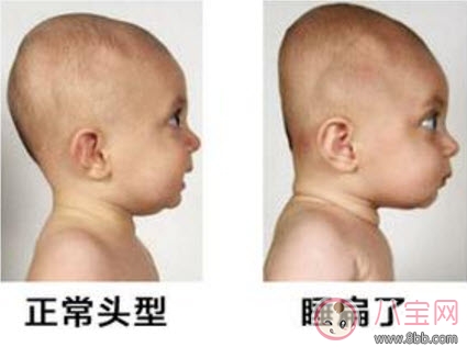 寶寶頭型睡偏了怎么辦 寶寶頭型調(diào)整怎么做