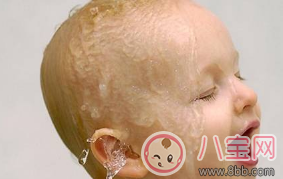 2017三伏天寶寶消化不良引起睡眠性出汗如何調(diào)理