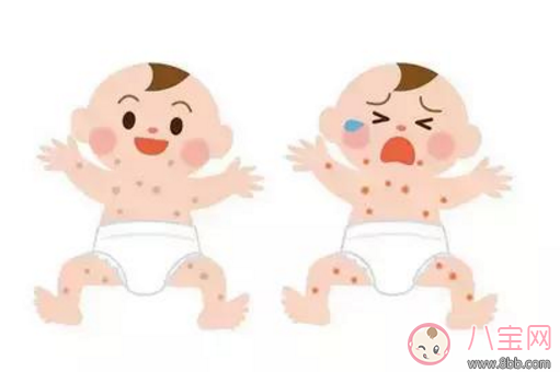 寶寶長痱子怎么辦 給寶寶去痱子的方法有哪些 寶寶長痱子怎么辦 給寶寶去痱子的方法有哪些