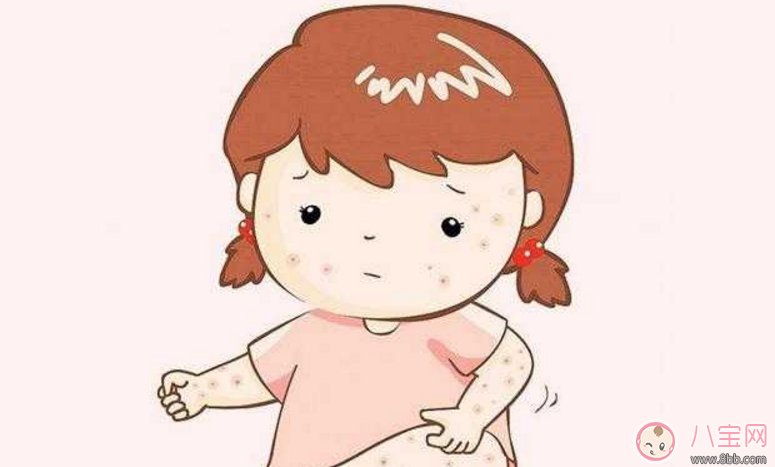 寶寶長痱子怎么辦 給寶寶去痱子的方法有哪些 寶寶長痱子怎么辦 給寶寶去痱子的方法有哪些