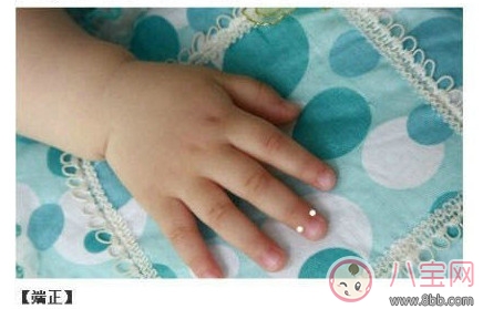 寶寶推拿大全 嬰幼兒常見病的最強(qiáng)克星