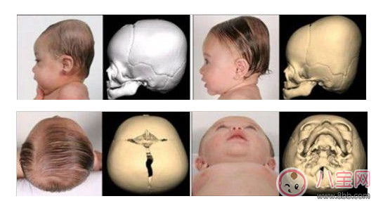 這些老方法，請(qǐng)不要再用到孩子的身上