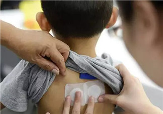 寶寶能貼三伏貼嗎，孩子多大能貼三伏貼