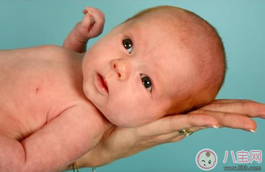 嬰兒常見皮膚問題怎么解決     尿布疹濕疹乳痂解決方法