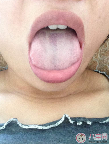 孩子脾虛的癥狀是什么 哪些情況是孩子脾虛了