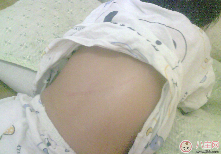 孩子經(jīng)常性的抓人怎么辦 孩子抓人多半是因?yàn)榧彝? alt=